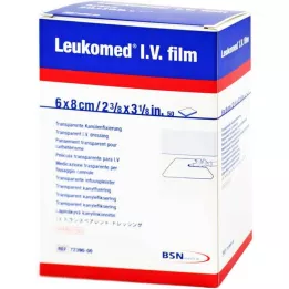 LEUKOMED I.V filmgips, 50 stk